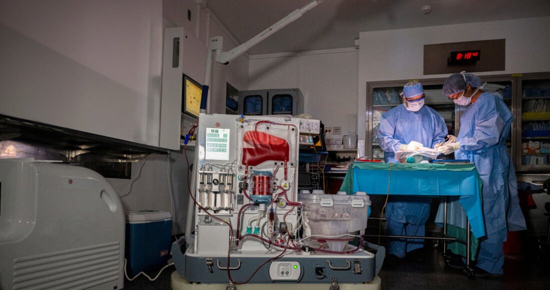 Liver Transplants